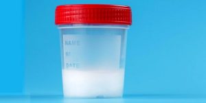 Lire la suite à propos de l’article Pourquoi mon sperme est gélatineux ?